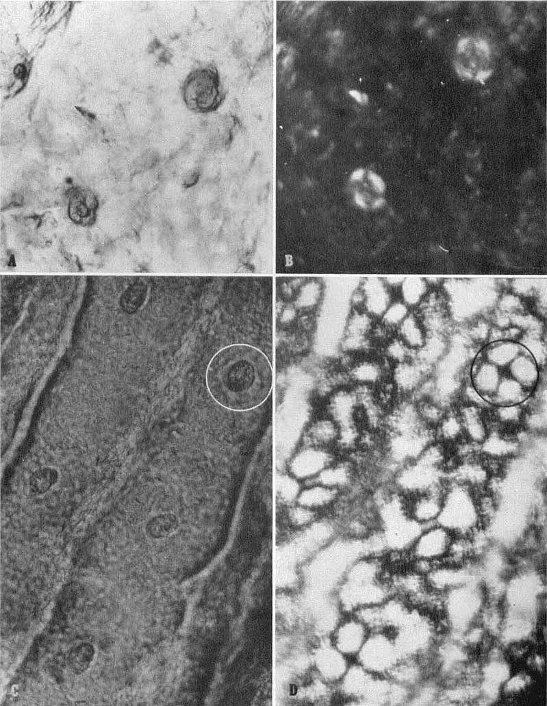 WHOLE MOUNTS FOR STUDY OF SKIN 449 4 1. FIG. 7. Whole mounts of separated epidermis with epidermal sweat ducts. A. Undersurface of presternal epidermis with two sweat duct coils.