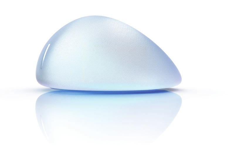 A significant milestone in the design and performance of the MENTOR CPG Gel Breast Implants Based on a decade of research into the safety and efficacy of breast implants, our Mentor Core Study 1