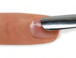 the nail plate. Remove any excess CuticleAway from the nail and use a curette to remove non-living tissue up to the eponychium and lateral folds. h.