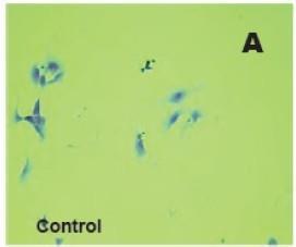 Vitro Test II Cellular morphology test: EGF effect on