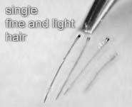 Then, moving back to the top of the scalp, we place FUs with two hairs featuring the single-hair effect when growing (Figure 5), or we plant two 1-hair graft pairs into one slit.