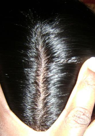 Because each hair is not knotted but injected into the thin skin material, there are no knots visible and hair appears to be growing right out of the skin s scalp.
