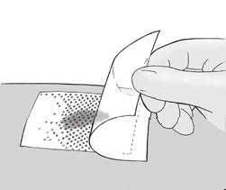 The dressing allows the passage of exudate. Remove the clear liners on each side of the dressing and place directly over the wound. Silflex may overlap the wound edges.