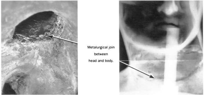 hair, opaque in the X-radiograph, are all thicker than the rest of the head: all were made of wax added to the working model, and all were modeled by hand to individualize the head and face before