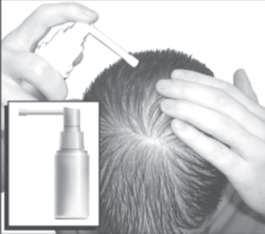 How to use this medicine Before you start to use this medicine, check with your doctor that your scalp is normal and healthy. This medicine is for use on the scalp only.