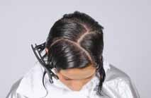 3 3 Begin sectioning at the front hairline on one side of the part. Comb the hair in the direction of growth.