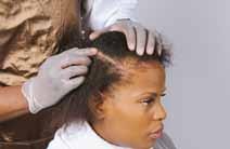 Only allow the relaxer to touch the scalp itself during the last few minutes of processing.