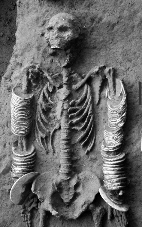 Figure 11 A man from Bronze Age 3A at Ban Non Wat, interred with multiple exotic marine shell and marble bangles. Scale 10 cm.
