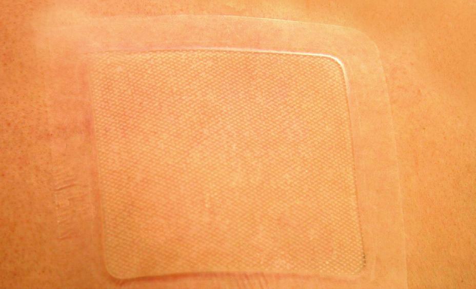 HCS (Hydrogel Colloidal Sheet) For dry to moderately exuding wounds XTRASORB HCS is a super-absorbent polymer-based hybrid of a hydrogel and hydrocolloid.
