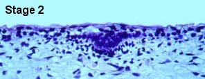 At stage 1, a few dermal fibroblast-like cells aggregate below the