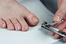 Cut or file your nails straight across and never shorter than the end of the toe.