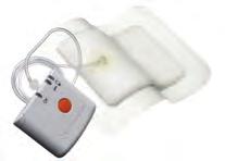 NEGATIVE PRESSURE WOUND THERAPY SYSTEMS PICO Single Use Negative Pressure Wound Therapy Negative Pressure Wound Therapy (NPWT) involves the application of controlled levels of sub-atmospheric