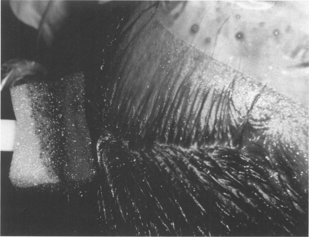 incision with a sterile comb. Figure 3.