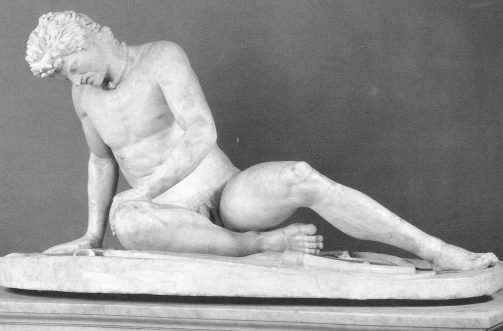 Fig. 9: Dying Gaul, after