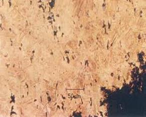 68 RANDA KAKISH Figure 9. Microscopic image of strigil artifact shows the mixed or bronzy patches appearance Figure 10.