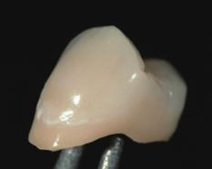 Adjustment of translucency Adjustment of occlusal center Applications of stains, hair lines and crack lines