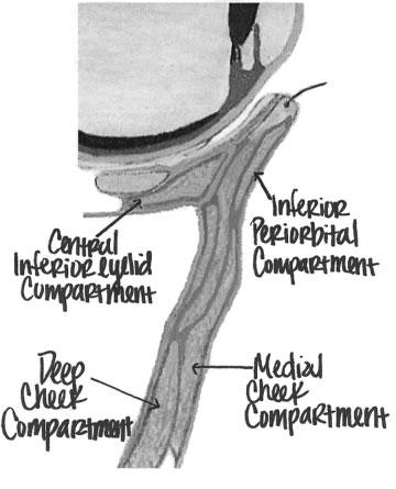 FACIAL FAT COMPARTMENTS/SANDOVAL ET AL 285 sub-orbicularis oris fat inferiorly. A portion of the compartment surrounds the levator anguli oris muscle.
