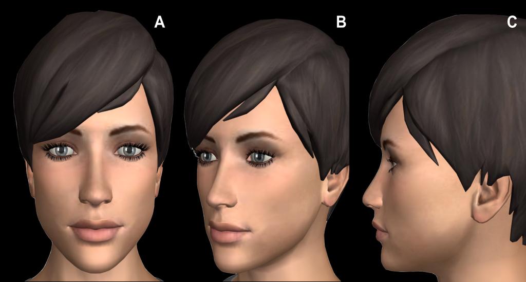 Figure 2. Facial proportion analysis. Soft tissue examination is performed in the three projections: frontal (A), oblique (B) and lateral view (C).