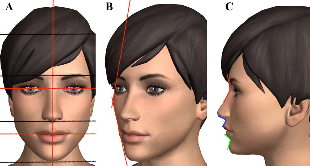 Figure 3. Facial proportion analyses. Frontal view (A).
