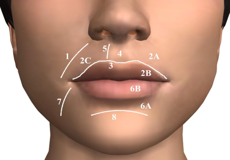 Figure 5. Aesthetic sub regions of the lip and perioral region.