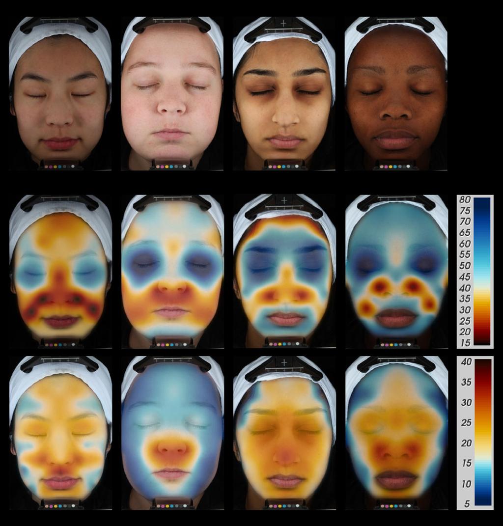 Figure 2 Continuous transepidermal water loss (TEWL) and capacitance colour maps of one selected subject per skin ethnicity, mean values of each group, from left: Chinese, Caucasians, Indians, ack