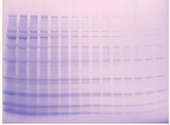 In comparative experiments, some proteins that were not detectable by the Silver Stain from Vendor B are clearly visible with GelCode SilverSNAP Stain.