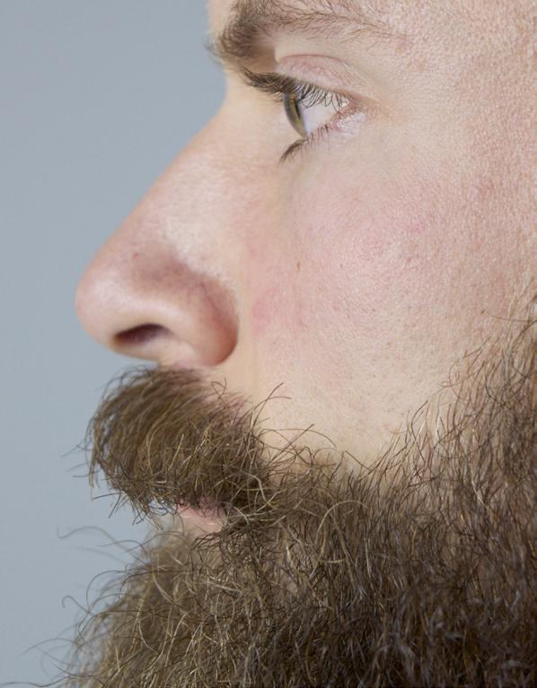 the Beard