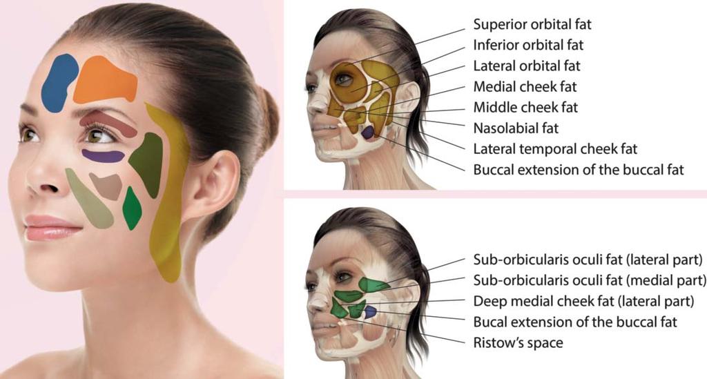 Facial quadralization 69 FIGURE 3: Fat compartments of the face.(adapted from Girloff et al. 2 ) medial cheek s fat compartment is subdivided into a medial and a lateral portion.