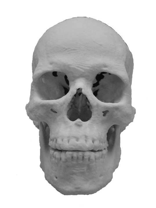 In the case of the Sulman mummy, residual brain material is visible on the radiographs as a cloudy mass in the cranium. This identification is confirmed by clearly visible sulci on the CT slices.