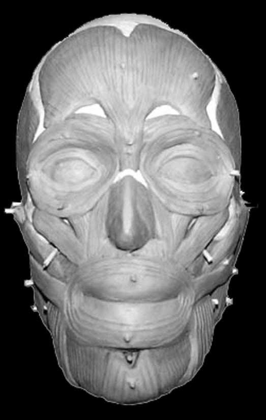PALEORADIOLOGY IN MUMMY STUDIES of wrappings. Density values suggest that it is metallic. There are also many small, hollow, low-density structures that appear to be wrapped around the head (Fig. 5).