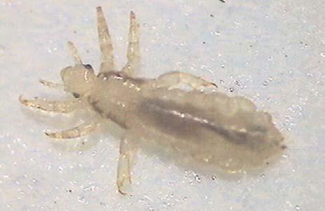 Figure 1. A magnified look at a head louse. Therapeutic failure is an increasing problem, and can be due to a number of different reasons.