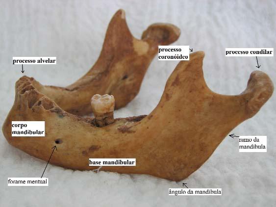 that region is marked by the angle of the mandible, which has 125 (range 110-140 ). Its greatest prominence, aligned laterally, is known as the gonion.