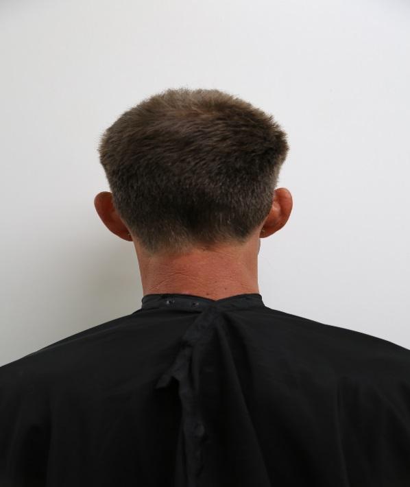 Half-Head Salon Study Figure 9. Full Head Baseline Photo of Untreated Hair.