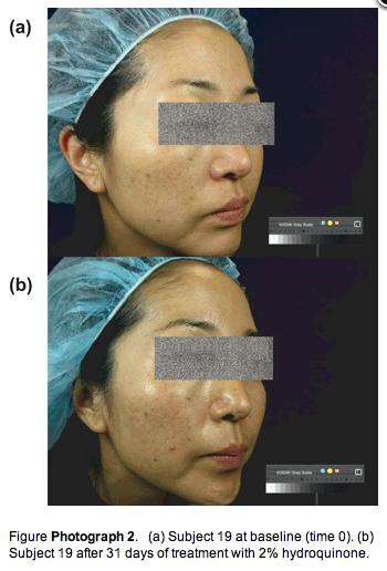 When considering the comparison of LIP-treated skin with the other products applied to the opposite side of the same patient s face, the mean changes from baseline were consistently greater with LIP