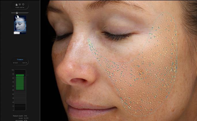 Biophysical Analysis Skin Elasticity Skin Hydration Skin Barrier