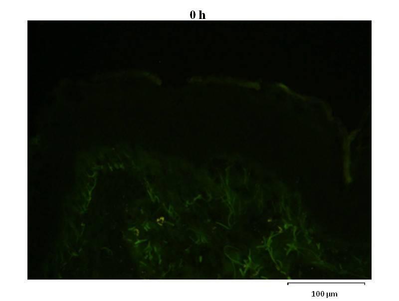 At 0h, the fluorescein fluorescence was not observed on the stratum corneum surface nether in stratum corneum (SC) and