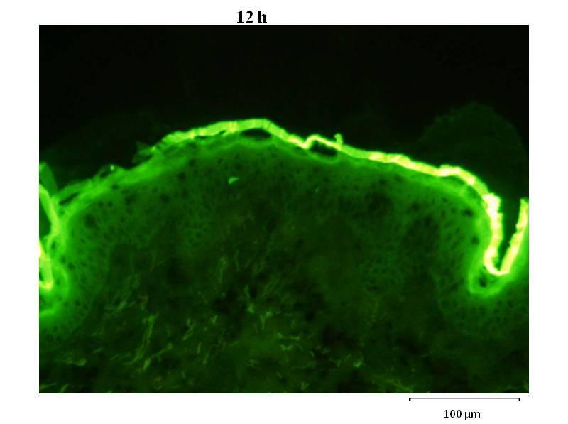 A very low autofluorescence was observed in papillary dermis (PD), especially on elastic fibers (figure 2A).