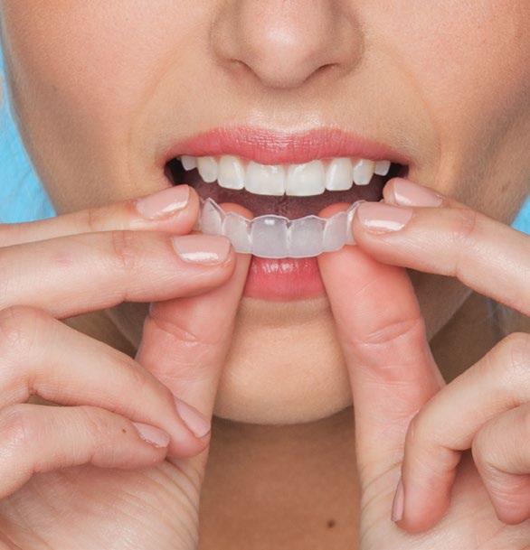 teeth undergoing treatment. 2.