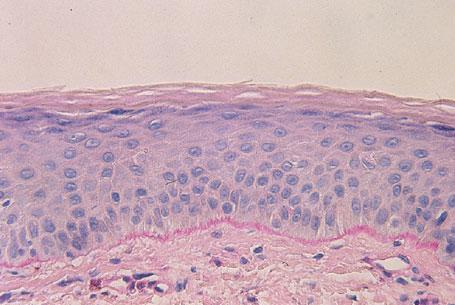 CHAPTER 2 Basic Science of the Dermis Leslie Baumann, MD Sogol Saghari, MD α 2 α 1 α 1 COSMETIC DERMATOLOGY: PRINCIPLES AND PRACTICE The dermis lies between the epidermis and the subcutaneous fat.