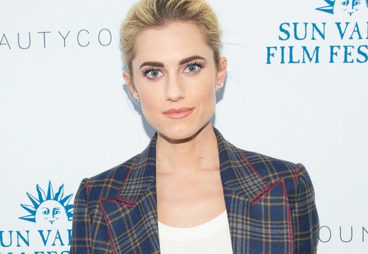 2 Allison Williams battled cystic acne and won. Like her Girls co-star, Williams developed a frustrating skin condition as an adult.