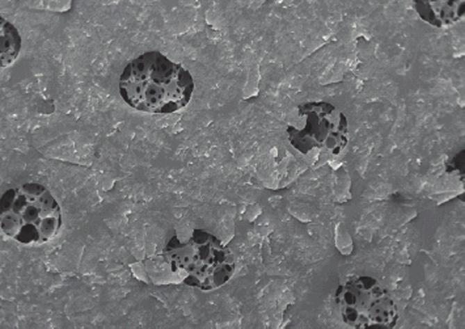 Dressing pore Epithelial cell Dressing pore Figure 1a. Scanning electron micrographs of dressing with soft silicone adhesive after removal. Note the lack of epidermal cells on its surface. Figure 1b.