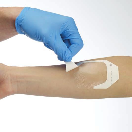 365 Film Dressings Description 365 Film is a sterile, latex free, self-adhesive, waterproof, transparent fi lm wound dressing.