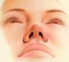 Nose Surgery While the shape of your nose is usually the result of heredity, the appearance may have been altered in an injury prior surgery.