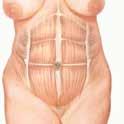Also known as abdominoplasty, a tummy tuck removes excess fat and skin, and in some cases restores weakened or