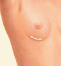 surrounding the nipple).