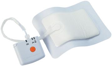 Edge of wound management Negative Pressure Wound Therapy devices and accessories NPWT efficiently promotes the healing of acute wounds, closed incisions and hard-to-heal chronic wounds by applying