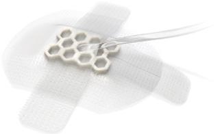 The pad surface leaves the wound site clean and comfortable, reducing the pain and site trauma when changing the dressing. Code Product description (dressing; pad) Items per unit 66000708 6.