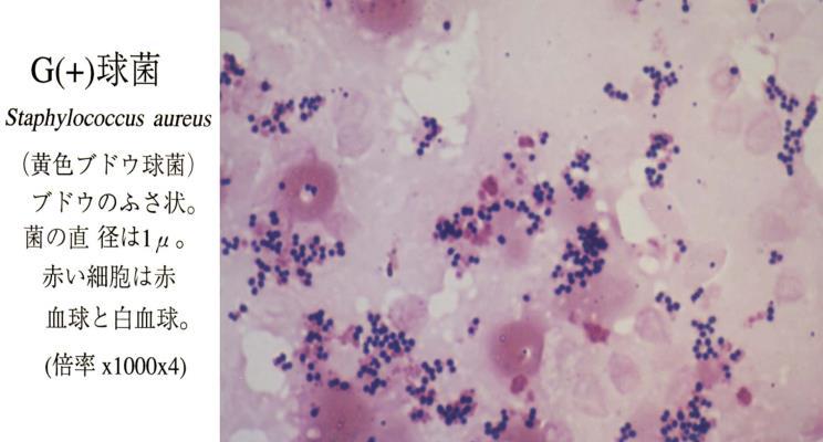 INTRODUCTION TO MMWR ARTICLE IDENTIFICATION OF MICROORGANISMS USING THE GRAM STAIN The first step in identifying microorganisms, specifically bacteria and fungus, is to perform a Gram stain.