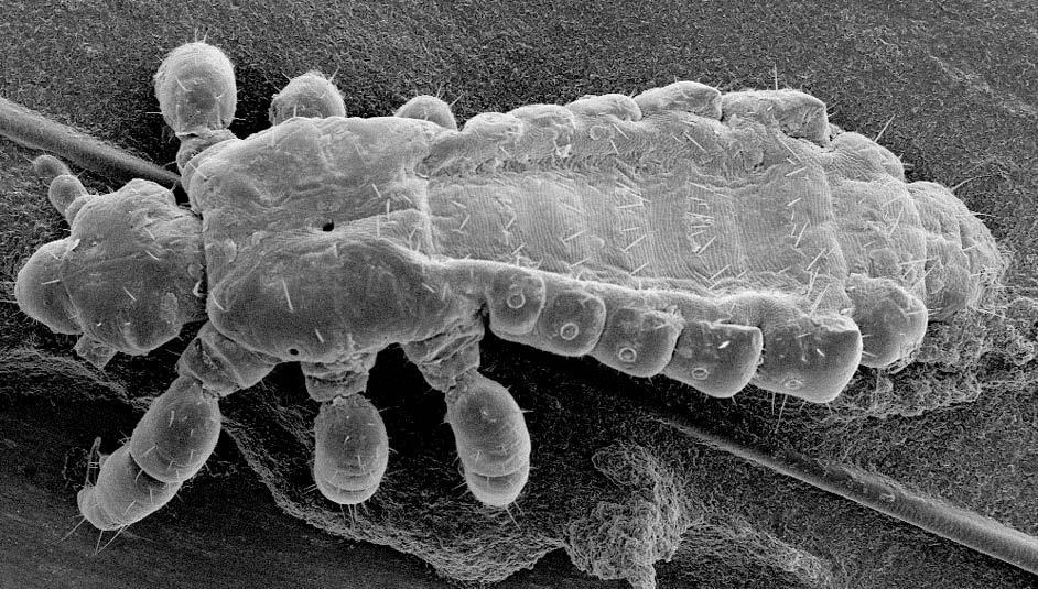 Peatäi (Pediculus humanus) Tiivutu putukas Seesamiseemne suurune (2-3 mm) Eluks vajab verd, mida imeb inimese peanahast Ilma verd imemata ei suuda elada kauem kui 55 tundi Ei kanna edasi viirusi