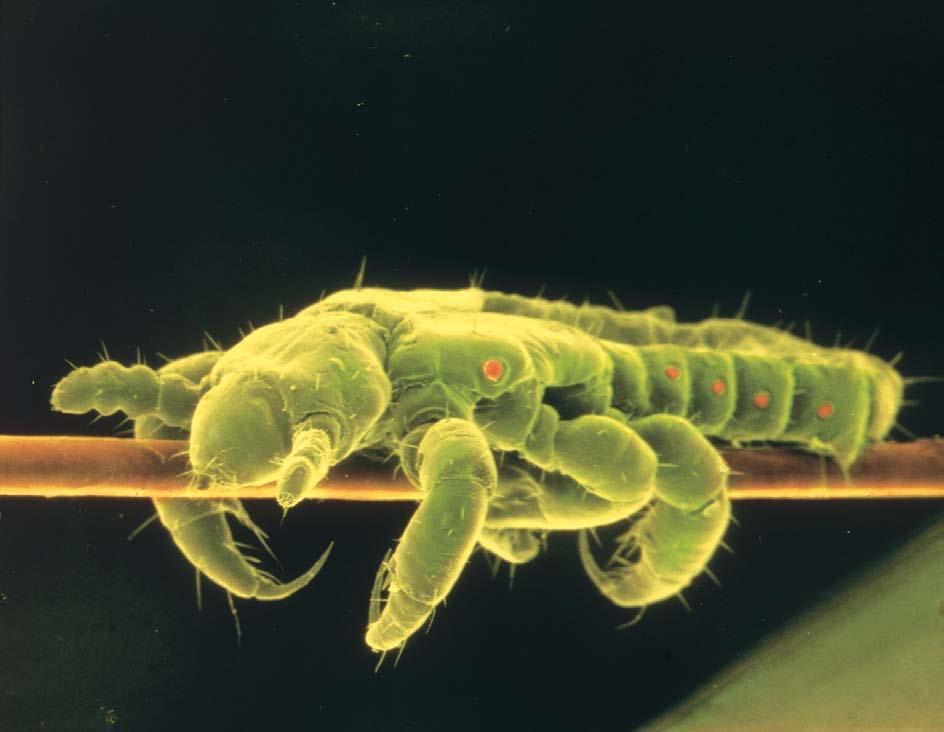 Head lice Caused by: a parasitic infestation Refer to GP/
